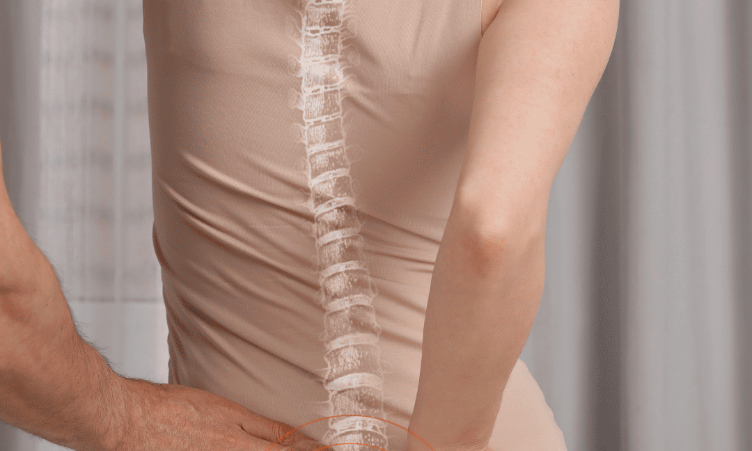 Differenza busti e corsetti ortopedici